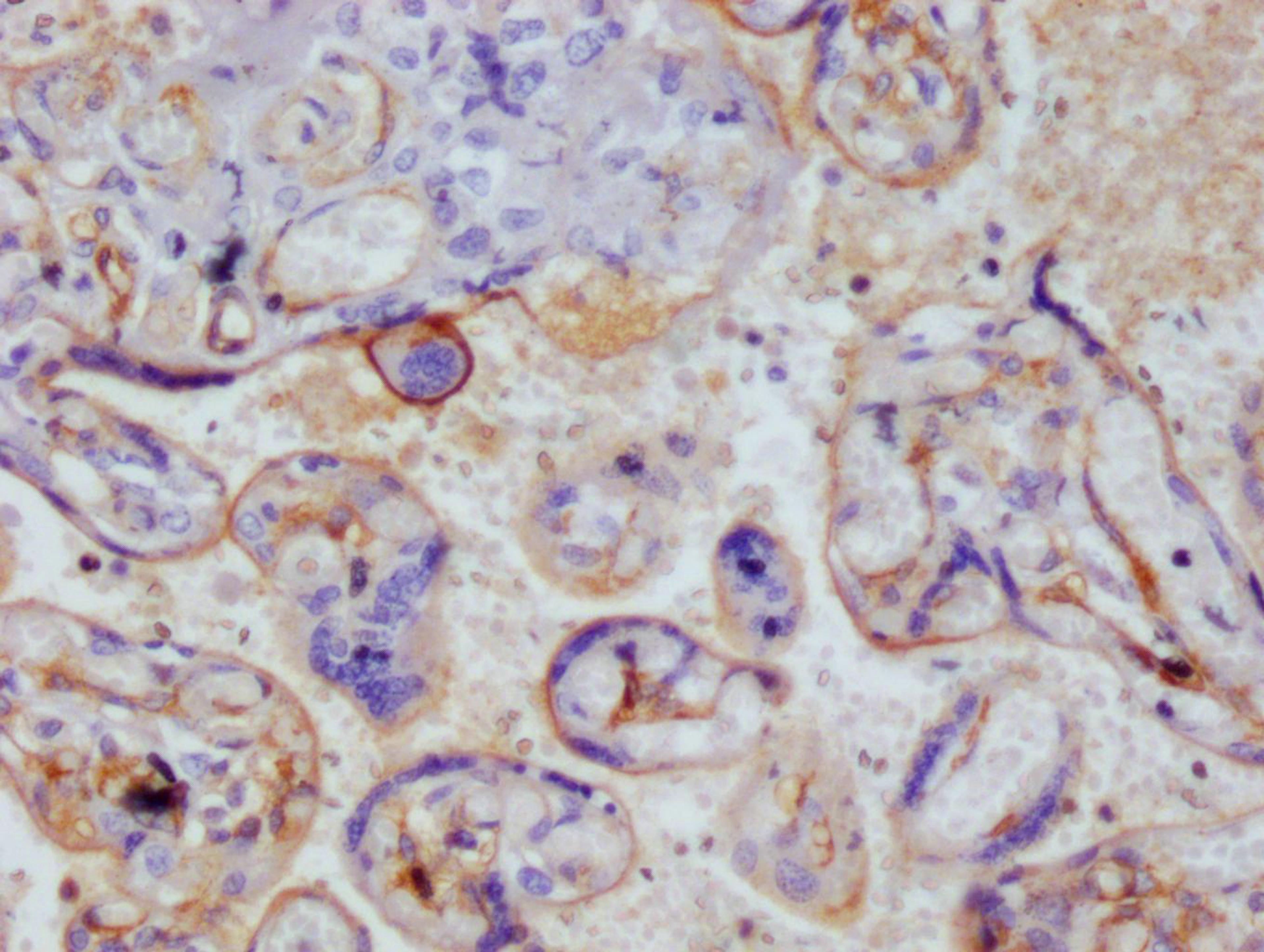 IHC image of CSB-RA222792A0HU diluted at 1:100 and staining in paraffin-embedded human placenta tissue performed on a Leica BondTM system. After dewaxing and hydration, antigen retrieval was mediated by high pressure in a citrate buffer (pH 6.0). Section was blocked with 10% normal goat serum 30min at RT. Then primary antibody (1% BSA) was incubated at 4°C overnight. The primary is detected by a Goat anti-rabbit polymer IgG labeled by HRP and visualized using 0.05% DAB.