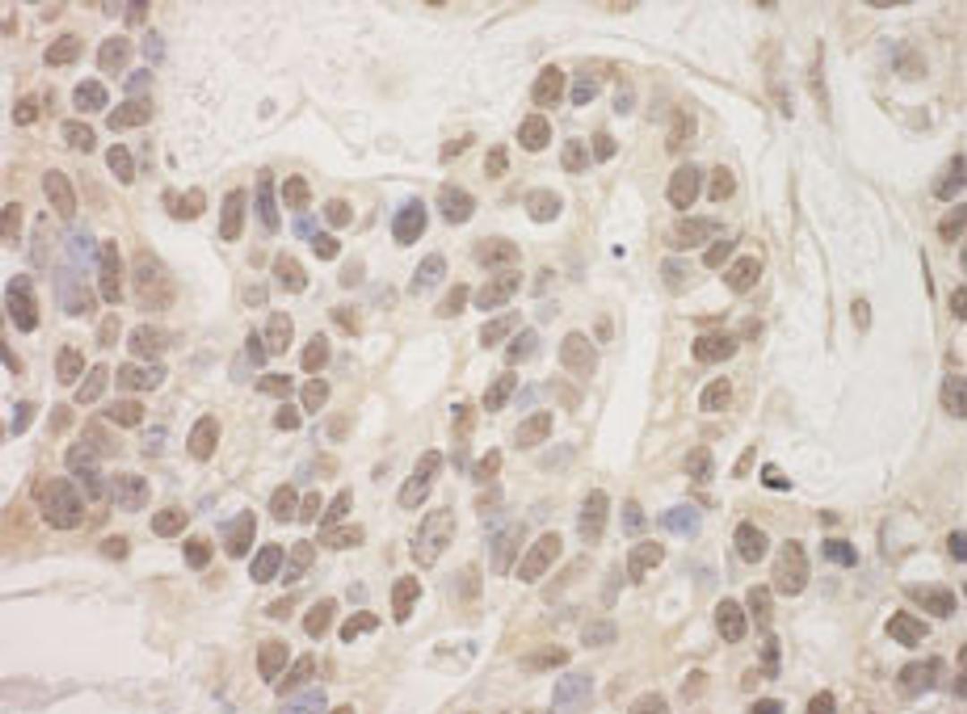 Detection of human SAP130 by immunohistochemistry.