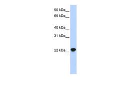 Antibody used in WB on Human Muscle at 0.2-1 ug/ml.