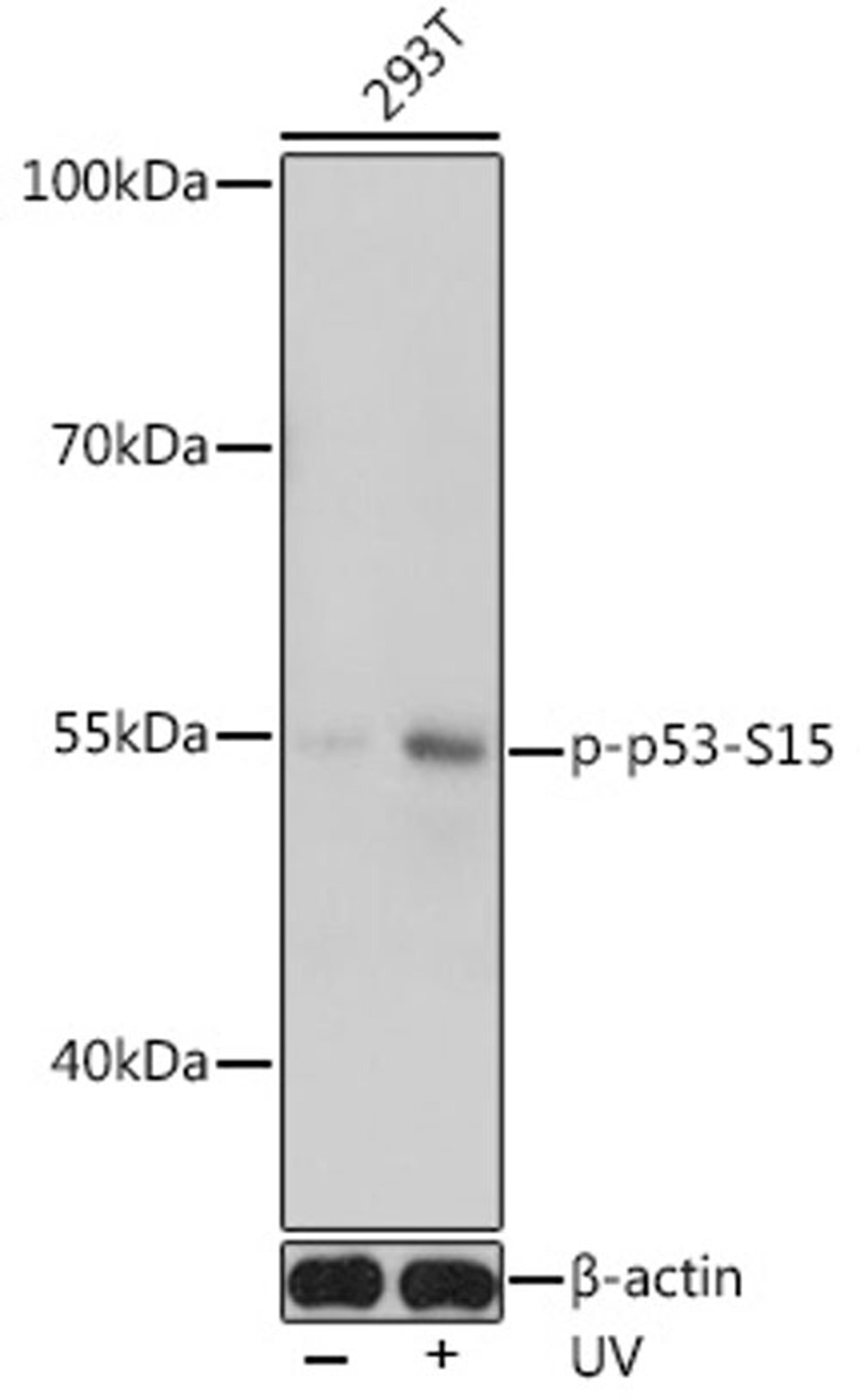 Western blot - Phospho-TP53-S15 antibody (AP0950)