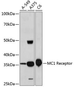 Western blot - MC1 Receptor Rabbit mAb (A11594)