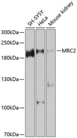 Western blot - MRC2 antibody (A9858)