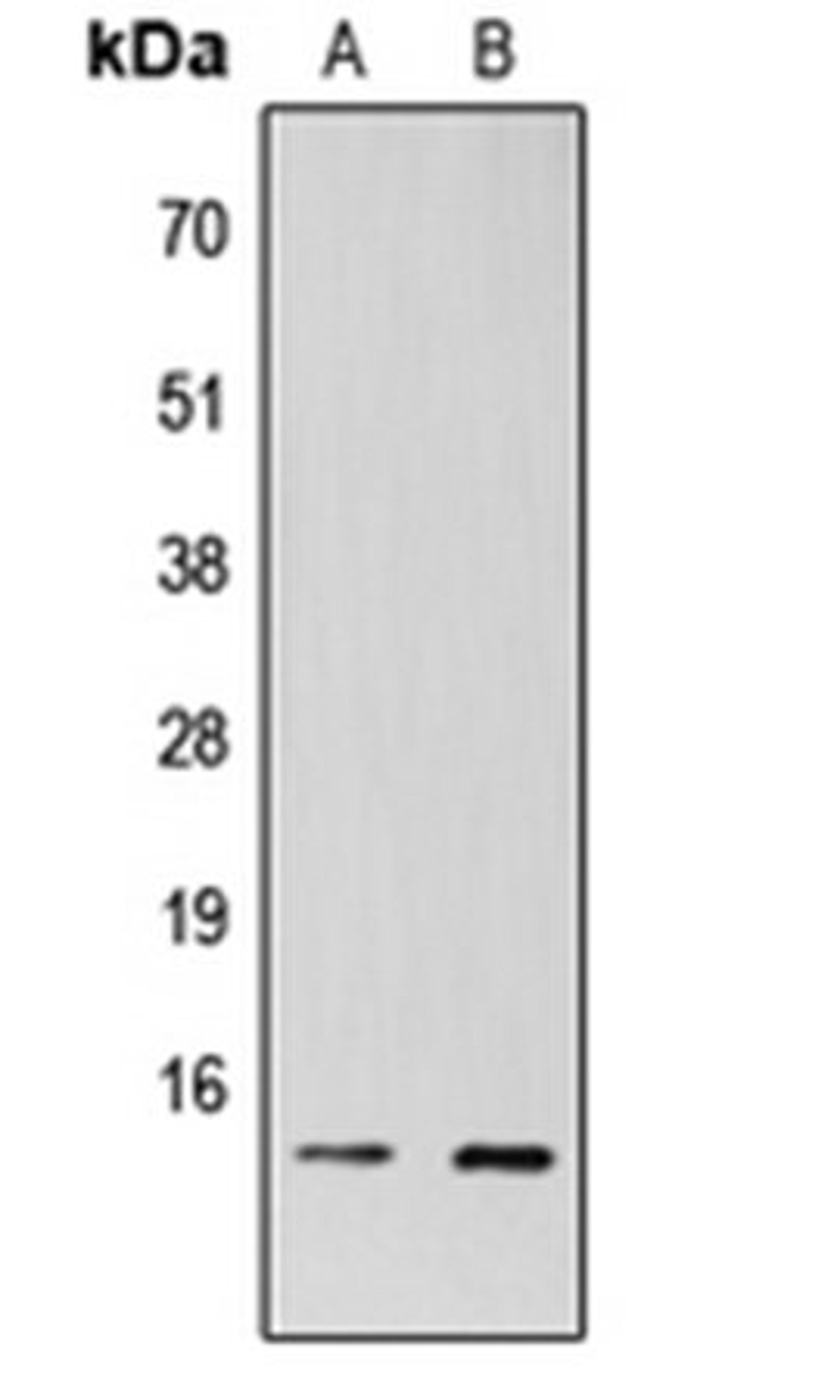 Western blot analysis of HEK293T (Lane 1), H9C2 (Lane 2) whole cell lysates using TAF13 antibody