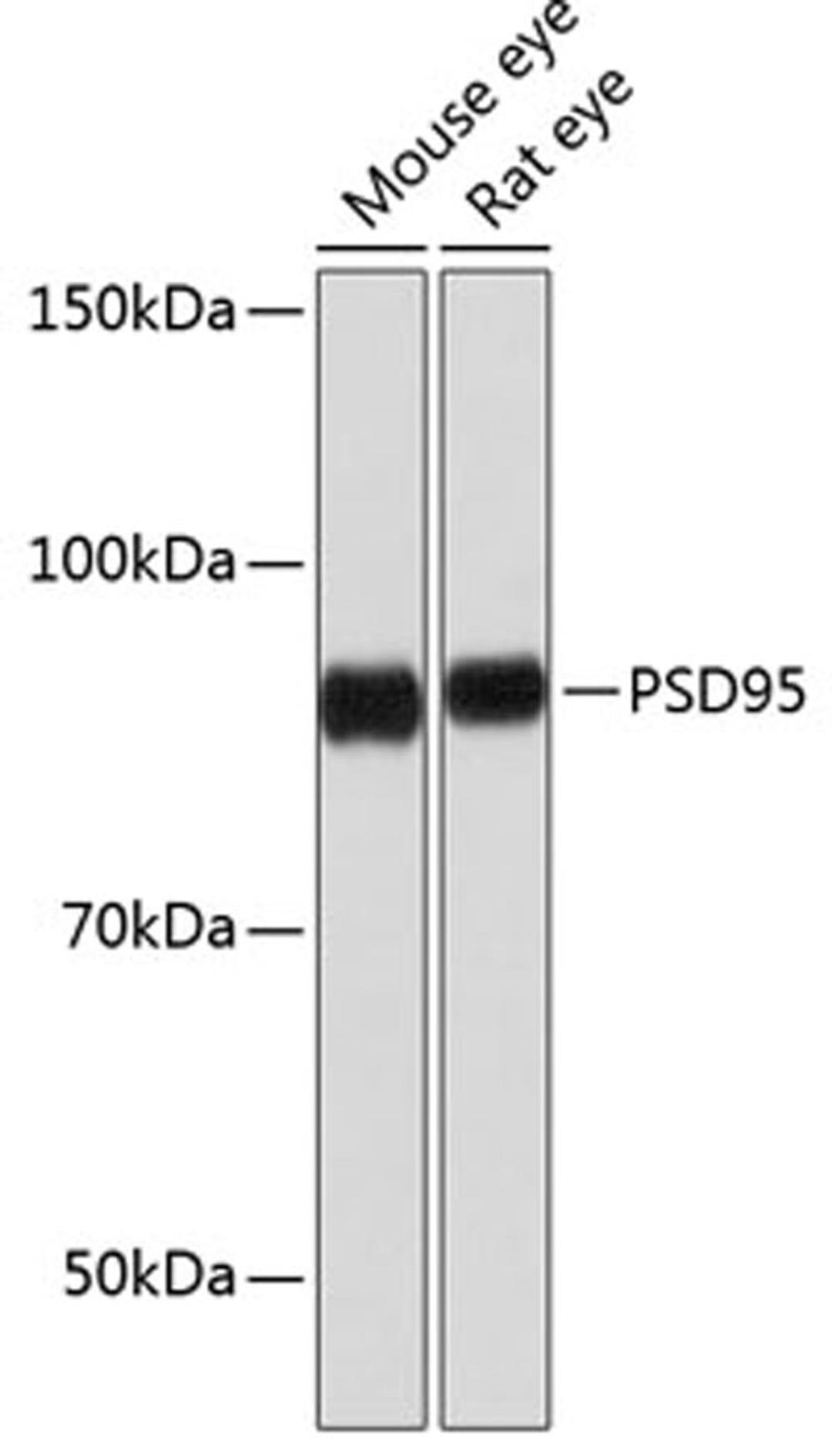 Western blot - PSD95   Rabbit mAb (A0131)