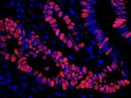 Detection of human p53 by immunofluorescence.