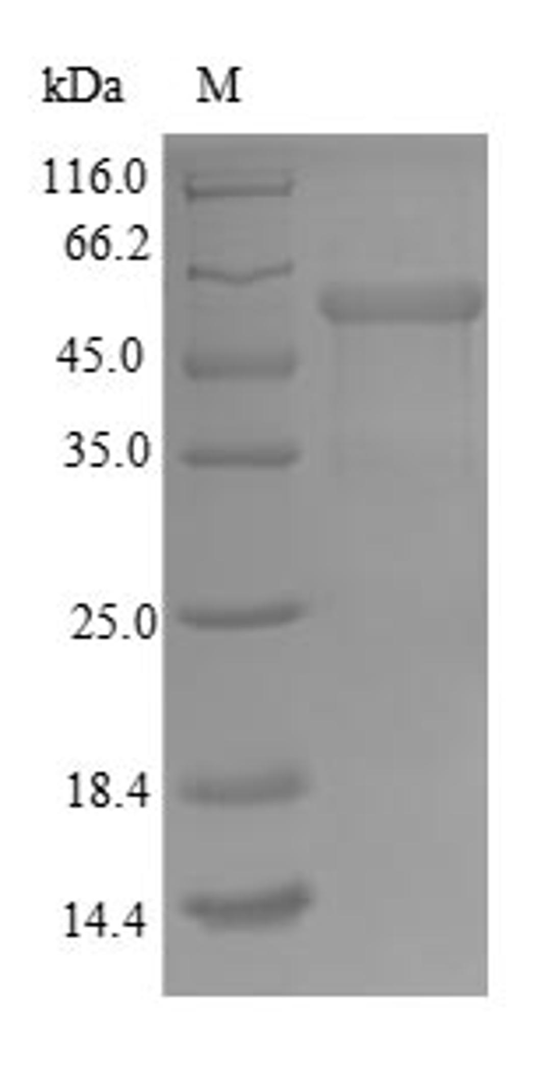 (Tris-Glycine gel) Discontinuous SDS-PAGE (reduced) with 5% enrichment gel and 15% separation gel.