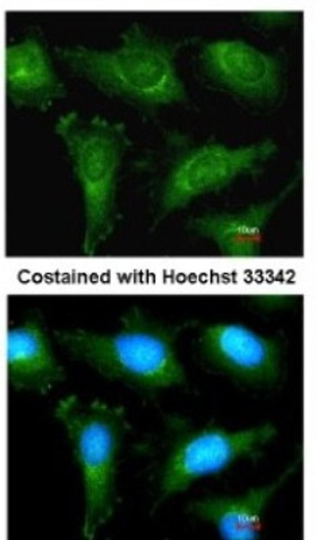 Immunocytochemistry/Immunofluorescence: Alpha Actinin 2 Antibody [NBP1-32462] - Analysis of methanol-fixed HeLa, using antibody at 1:200 dilution.