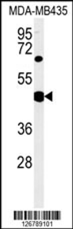 Western blot analysis in MDA-MB435 cell line lysates (35ug/lane).