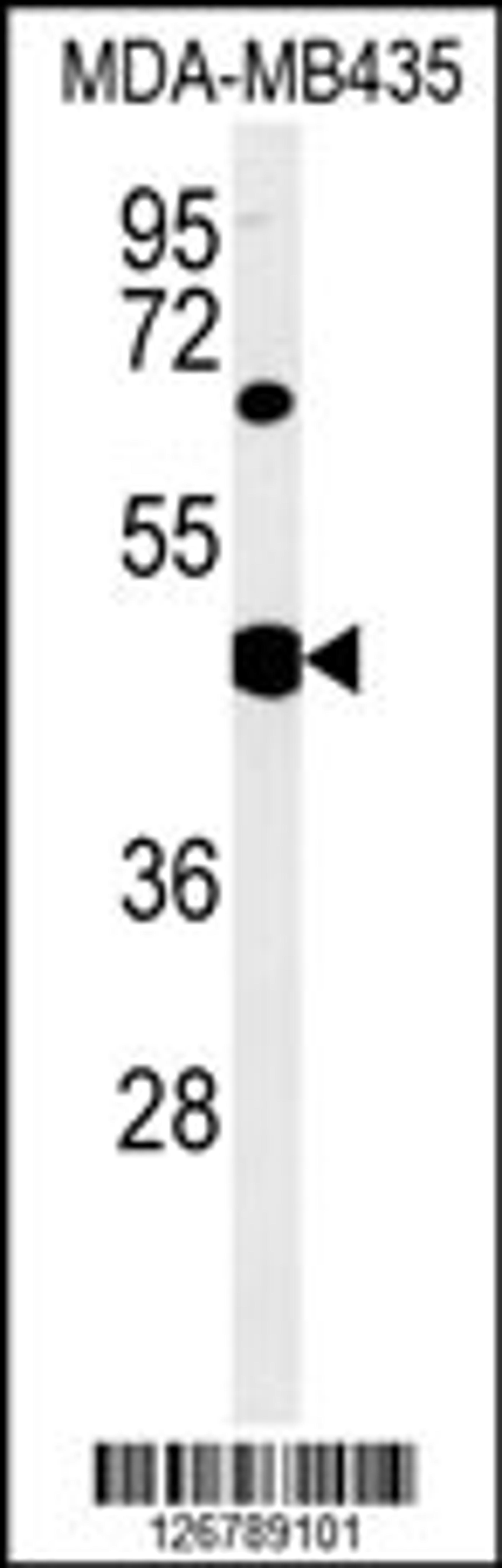 Western blot analysis in MDA-MB435 cell line lysates (35ug/lane).