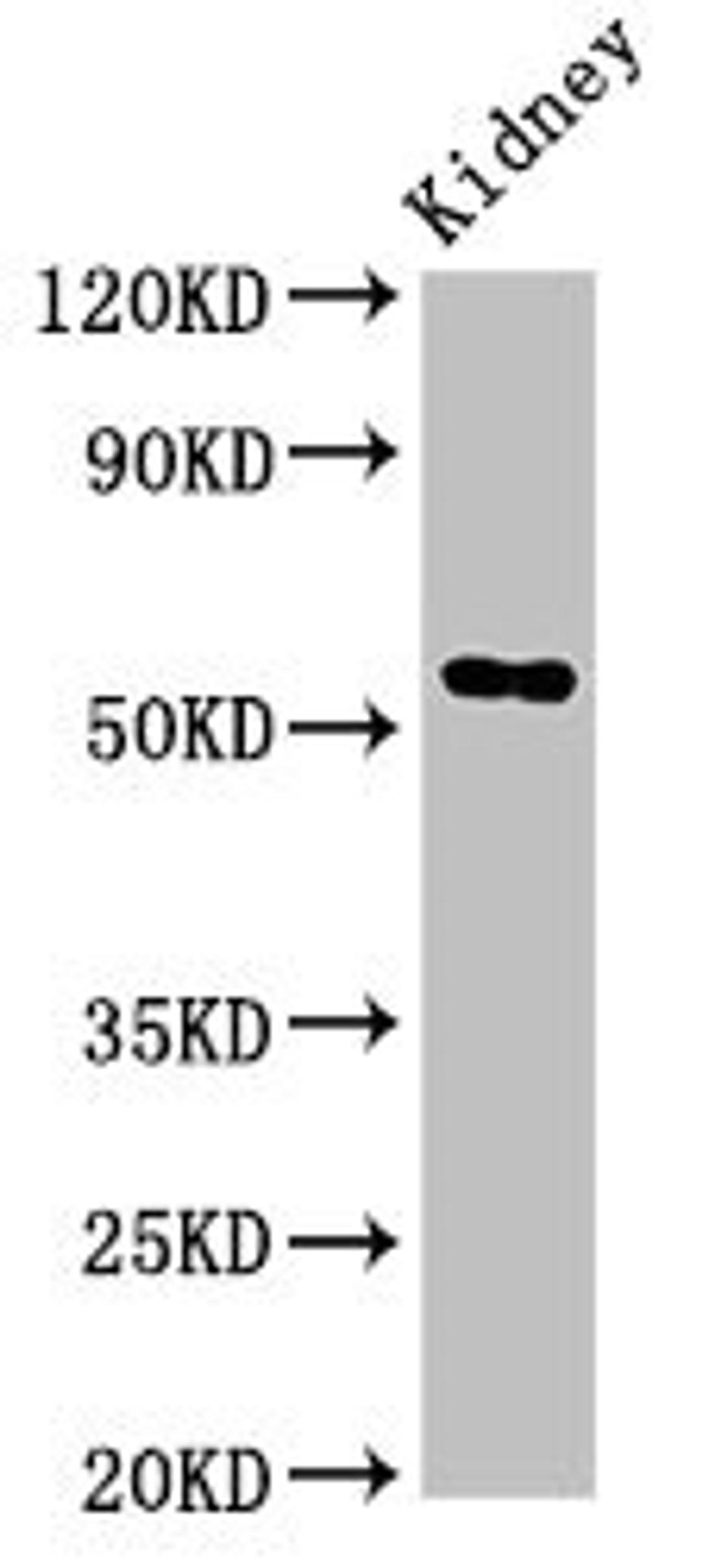 Western Blot. Positive WB detected in: Rat kideny tissue. All lanes: Fuca1 antibody at 3.4ug/ml. Secondary. Goat polyclonal to rabbit IgG at 1/50000 dilution. Predicted band size: 53 kDa. Observed band size: 53 kDa. 