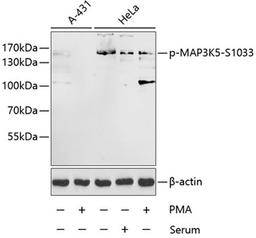 Western blot - Phospho-MAP3K5-S1033 antibody (AP0058)