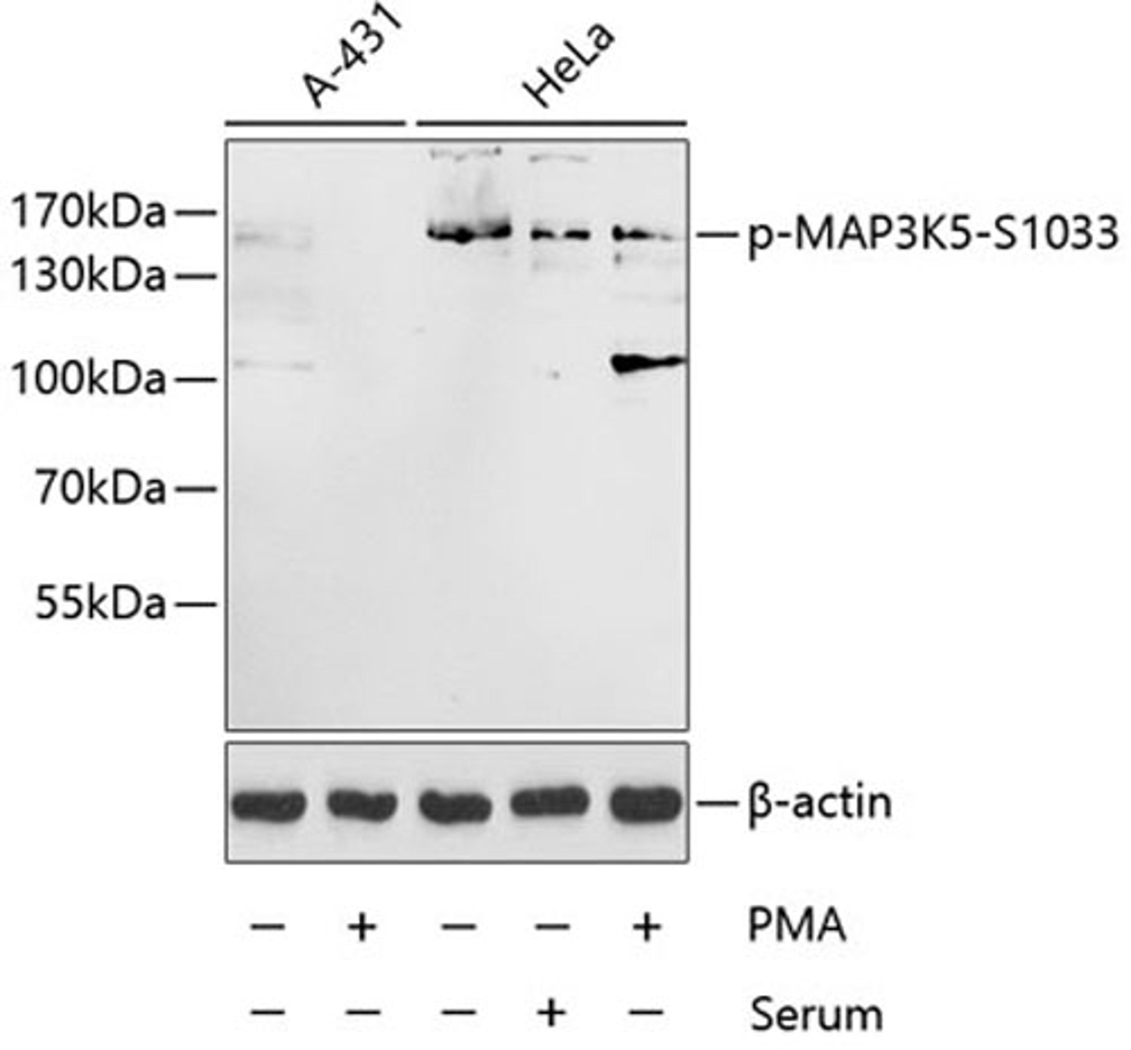 Western blot - Phospho-MAP3K5-S1033 antibody (AP0058)