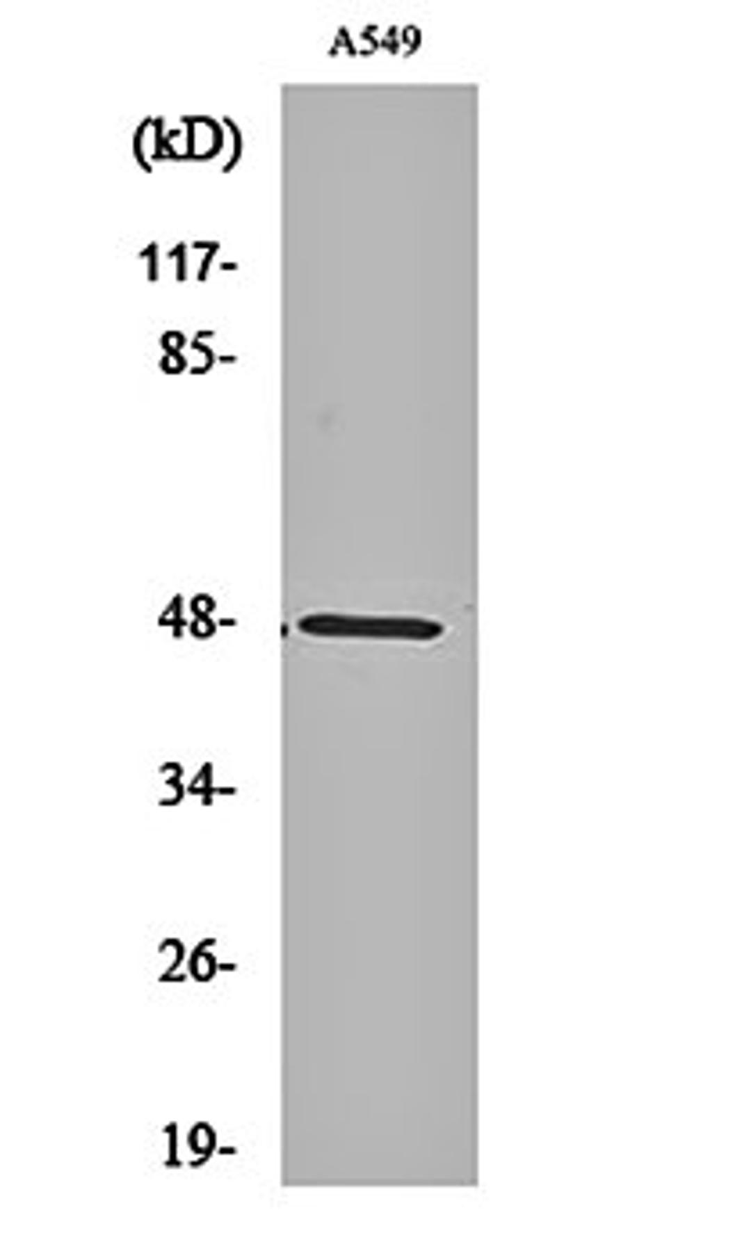 Western blot analysis of A549 cell lysates using PSK-H1 antibody