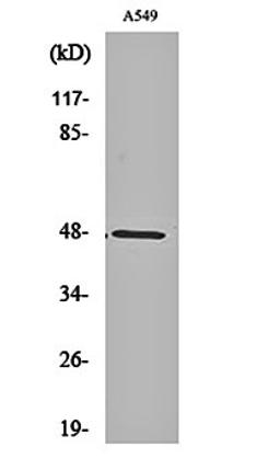 Western blot analysis of A549 cell lysates using PSK-H1 antibody