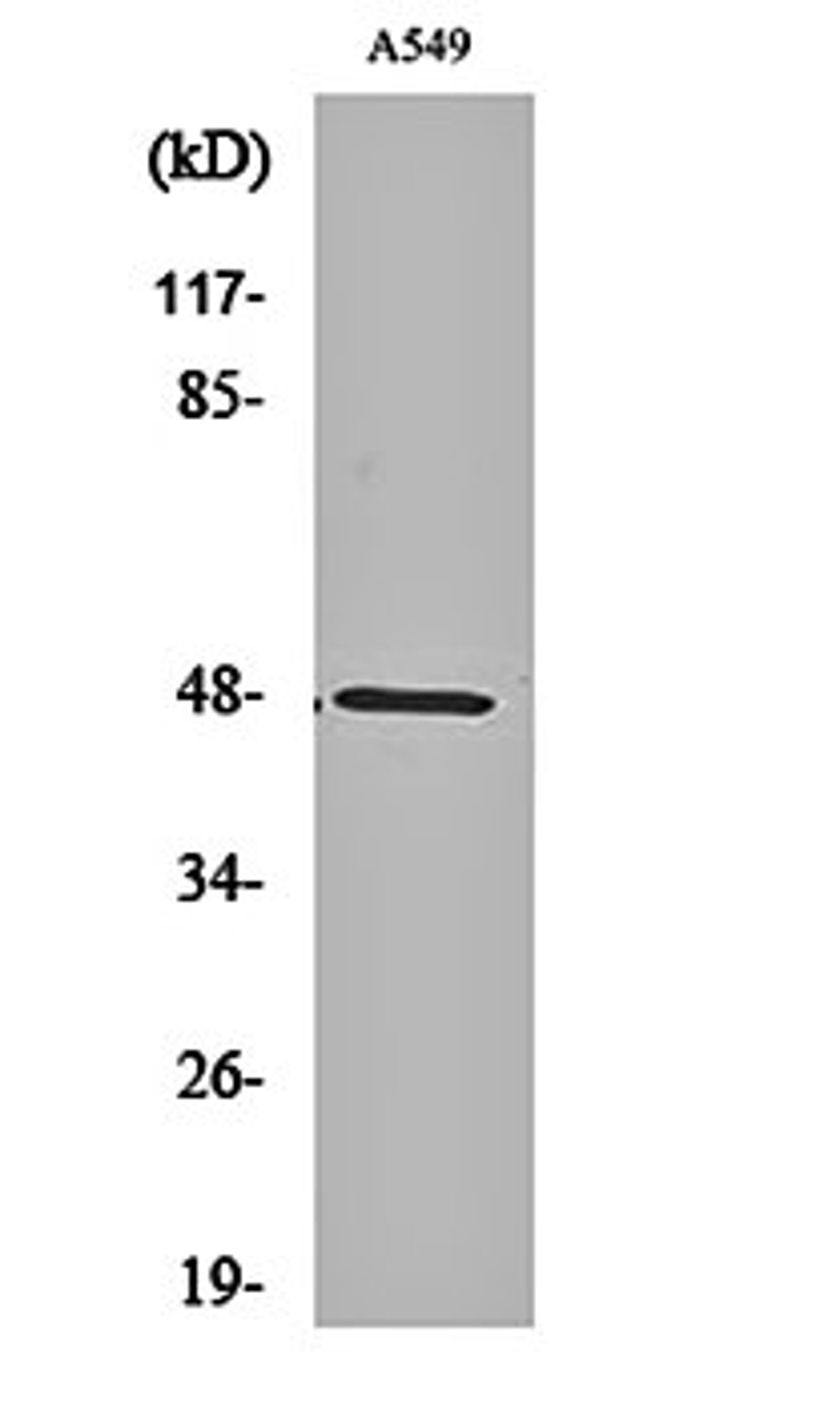 Western blot analysis of A549 cell lysates using PSK-H1 antibody