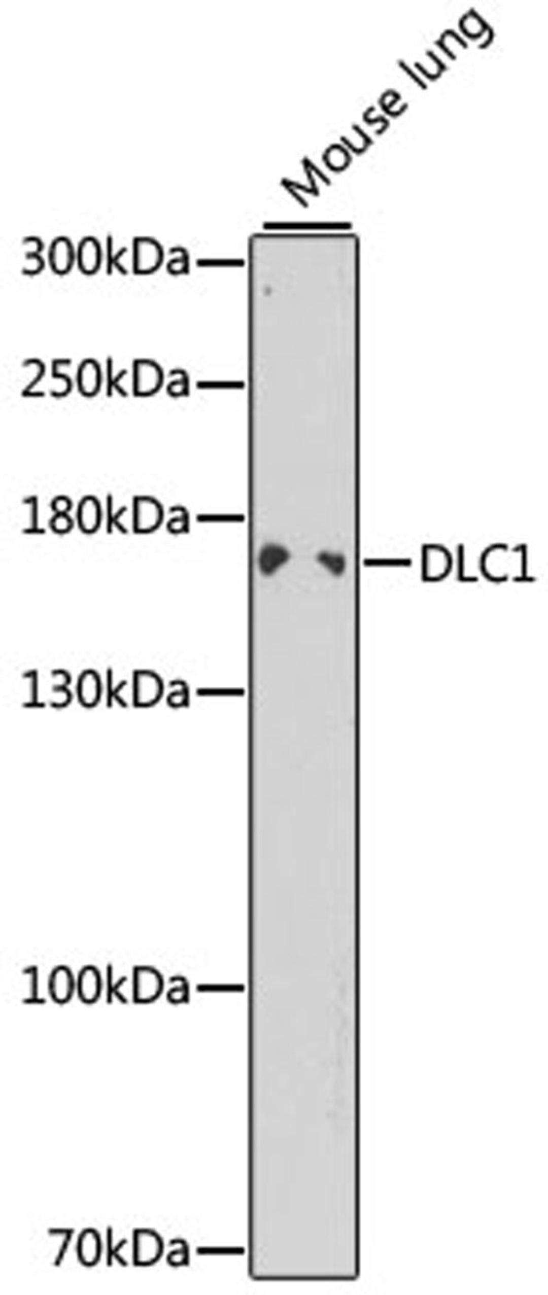 Western blot - DLC1 antibody (A1921)