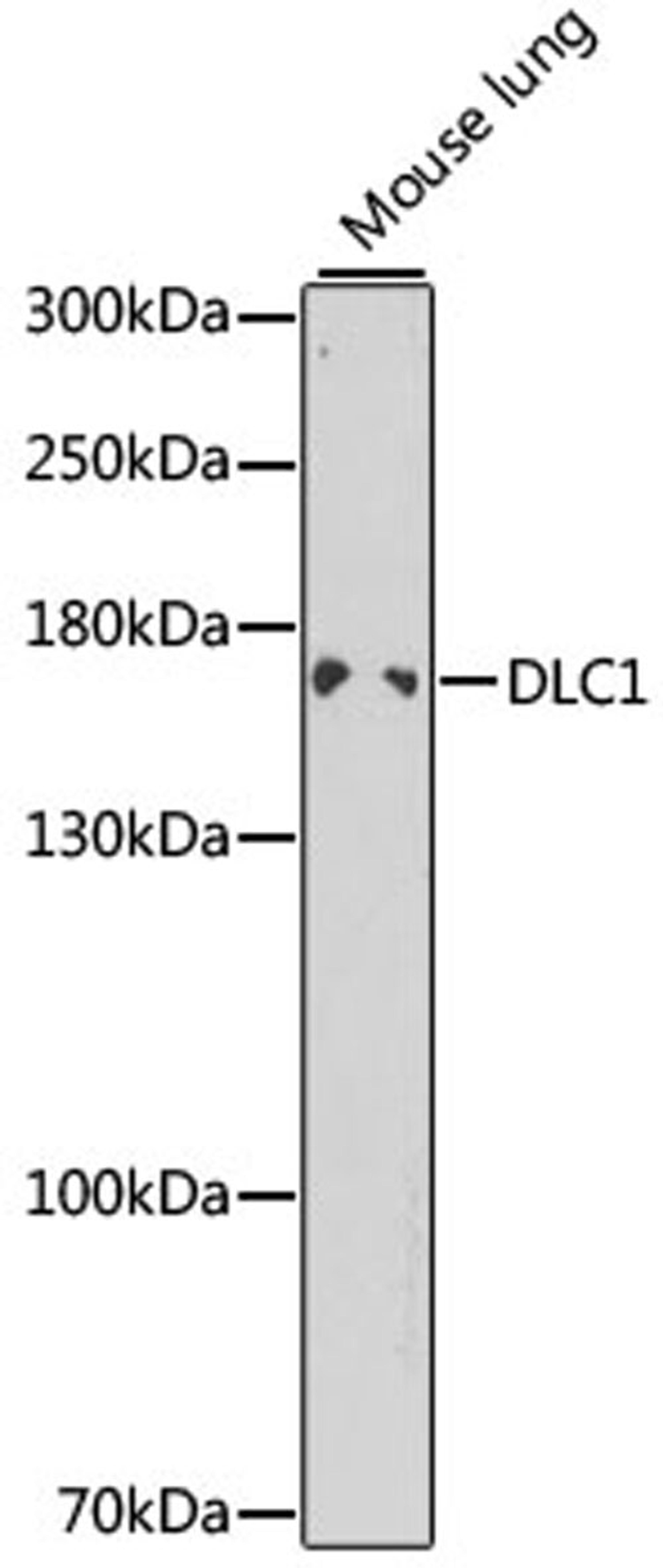 Western blot - DLC1 antibody (A1921)