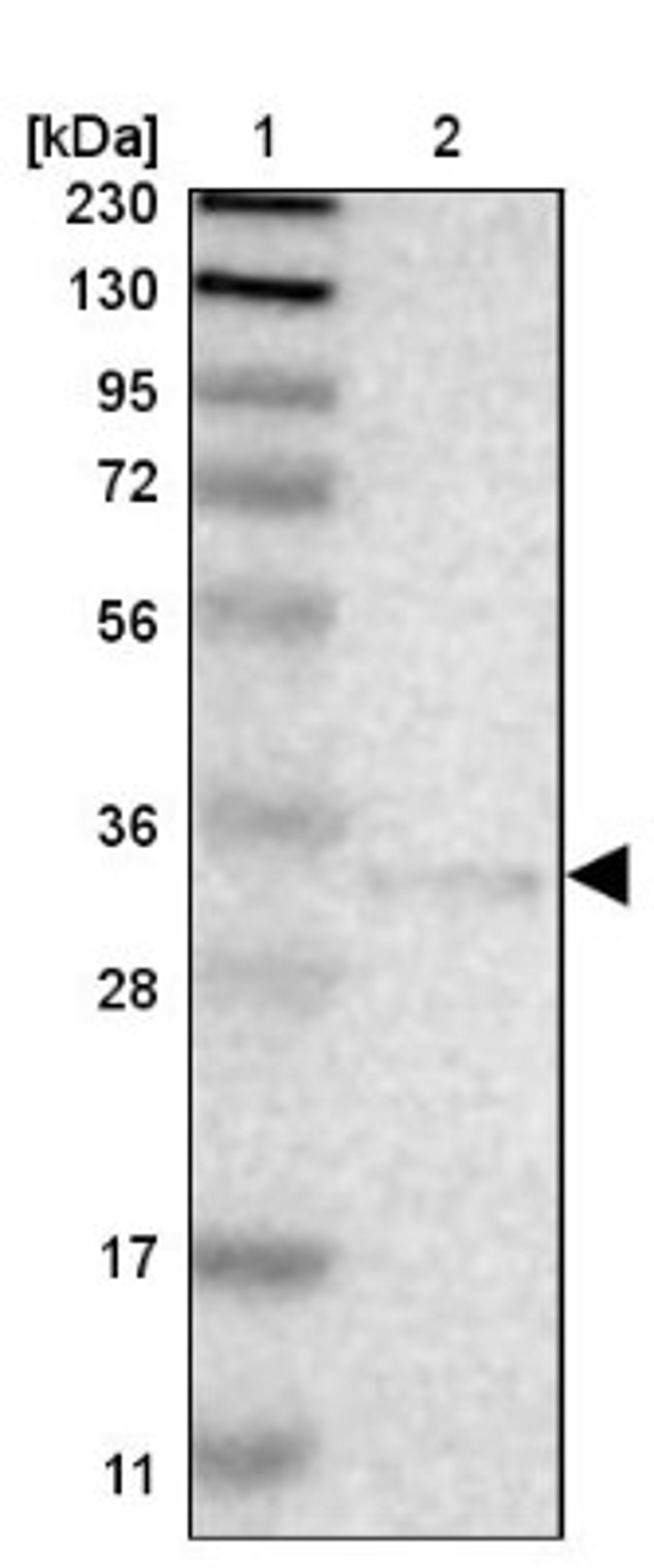 Western Blot: EB3 Antibody [NBP1-84924] - Lane 1: Marker [kDa] 230, 130, 95, 72, 56, 36, 28, 17, 11<br/>Lane 2: Human cell line RT-4