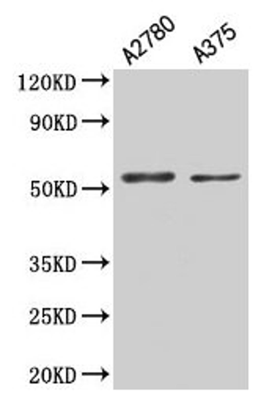 Western Blot. Positive WB detected in: A2780 whole cell lysate, A375 whole cell lysate. All lanes: PAX3 antibody at 5.3µg/ml. Secondary. Goat polyclonal to rabbit IgG at 1/50000 dilution. Predicted band size: 53, 25, 23, 45, 46, 54, 56 kDa. Observed band size: 53 kDa