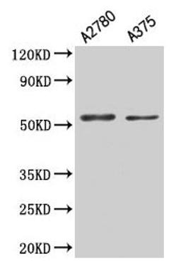 Western Blot. Positive WB detected in: A2780 whole cell lysate, A375 whole cell lysate. All lanes: PAX3 antibody at 5.3µg/ml. Secondary. Goat polyclonal to rabbit IgG at 1/50000 dilution. Predicted band size: 53, 25, 23, 45, 46, 54, 56 kDa. Observed band size: 53 kDa