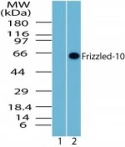 Western Blot: Frizzled-10 Antibody [NBP2-23659] - Analysis of Frizzled-10 in human brain lysate. Lane 1 shows pre-immune sera and Lanes 2 show NBP2-23659 tested on human at 1:1000 dilution.