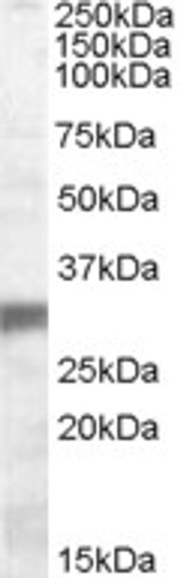 45-520 (0.1ug/ml) staining of Human Muscle lysate (35ug protein in RIPA buffer). Primary incubation was 1 hour. Detected by chemiluminescence.