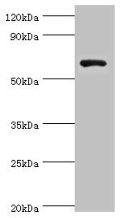 Western blot. All lanes: Glutamate decarboxylase 1 antibody at 8ug/ml + HepG2 whole cell lysate. Secondary. Goat polyclonal to rabbit IgG at 1/10000 dilution. Predicted band size: 67, 26, 48 kDa. Observed band size: 67 kDa.