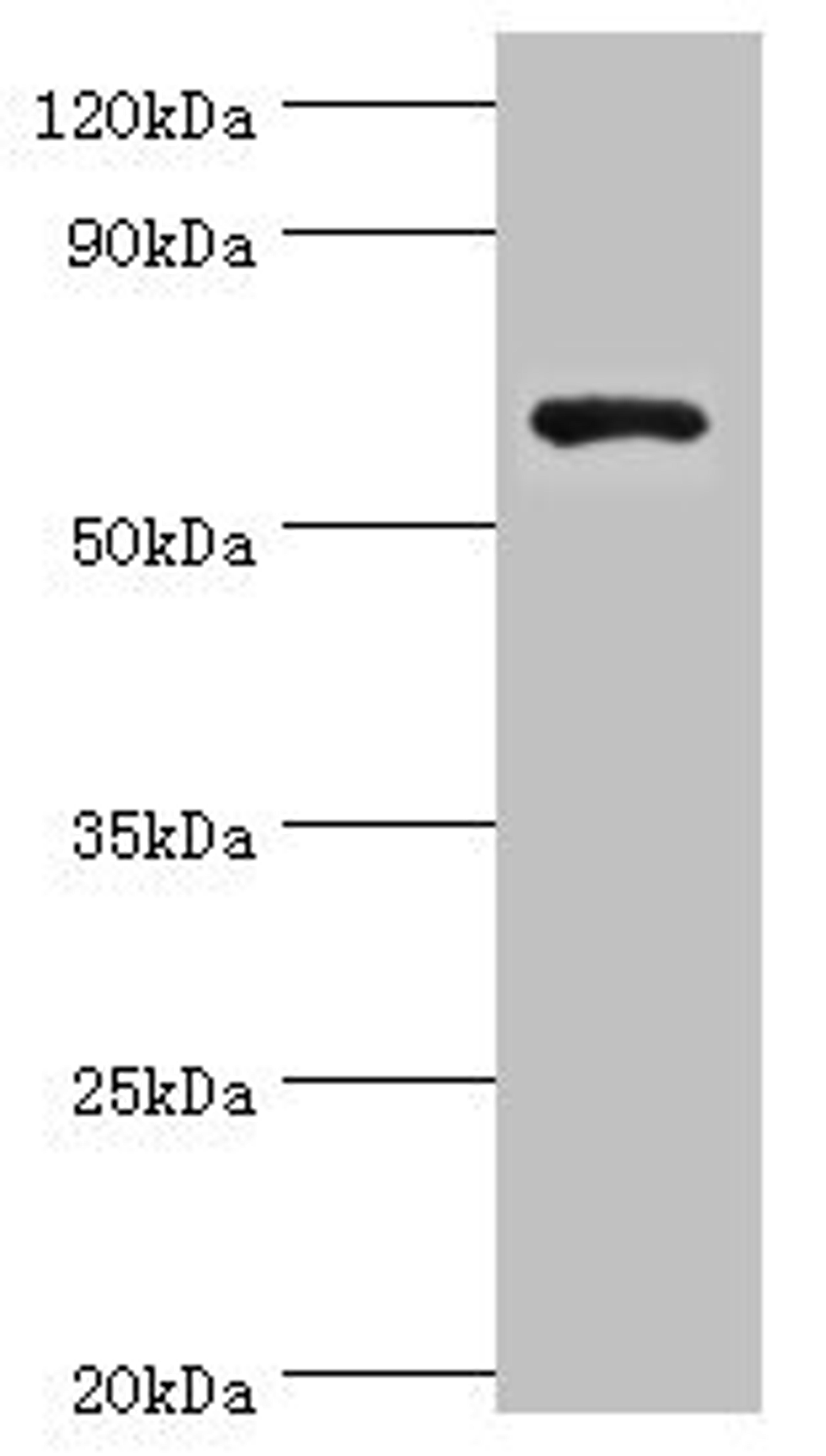 Western blot. All lanes: Glutamate decarboxylase 1 antibody at 8ug/ml + HepG2 whole cell lysate. Secondary. Goat polyclonal to rabbit IgG at 1/10000 dilution. Predicted band size: 67, 26, 48 kDa. Observed band size: 67 kDa.