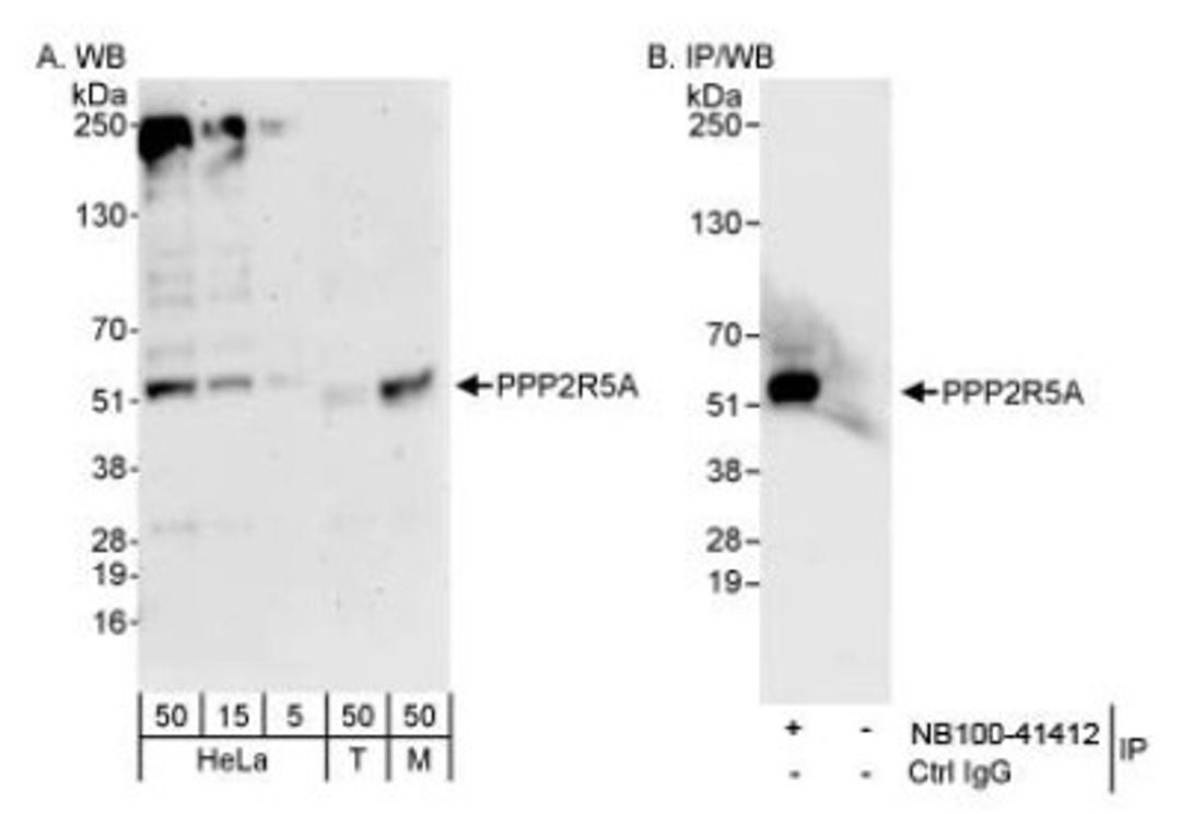 Western Blot: PPP2R5A Antibody [NB100-41412] - Detection of Human and Mouse PPP2R5A on HeLa whole cell lysate using NB100-41412.