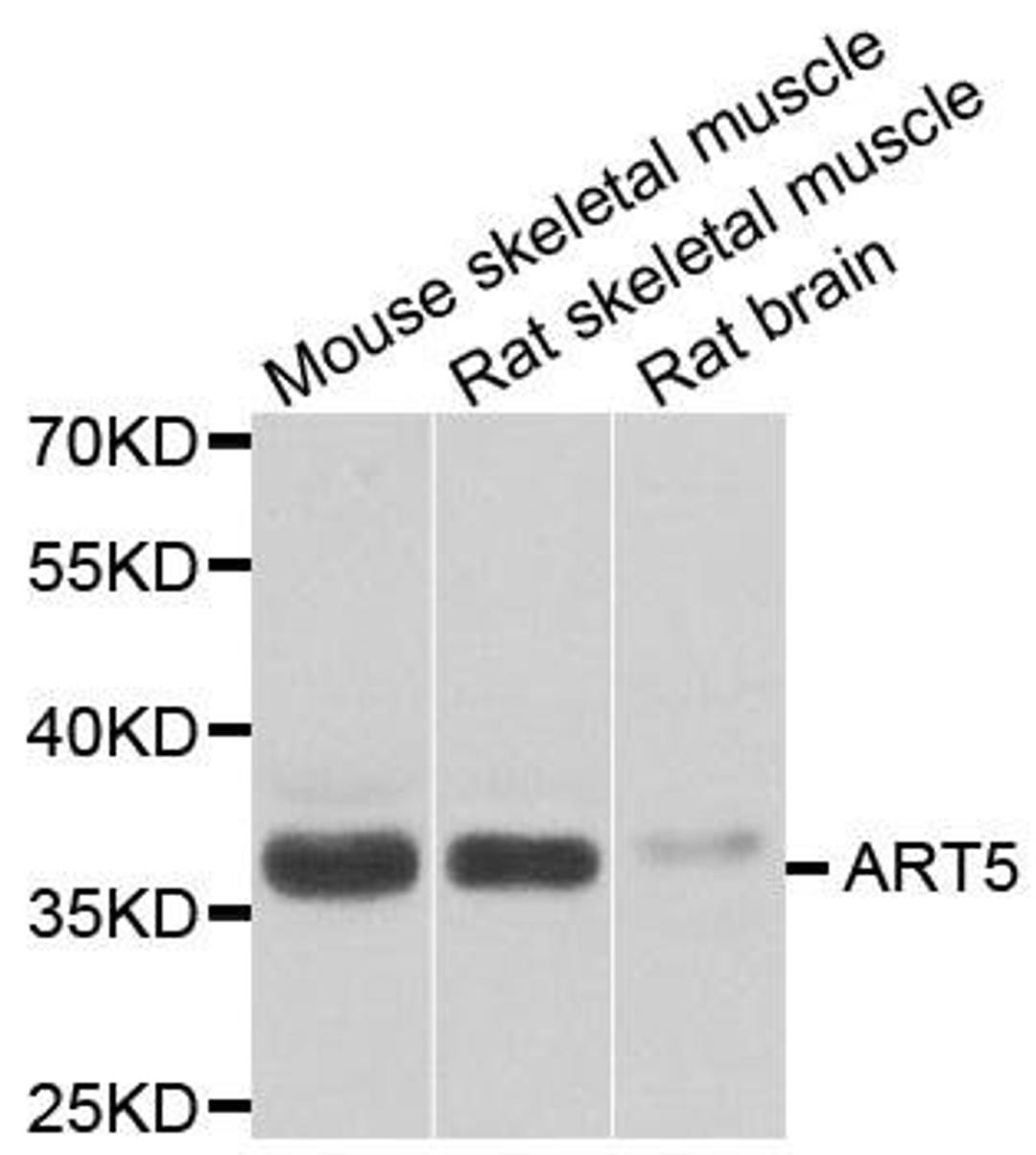 Western blot analysis of extracts of various cell lines using ART5 antibody