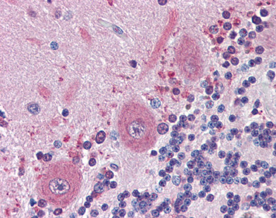 Immunohistochemistry of human cerebellum tissue stained using BRAF Monoclonal Antibody.