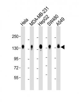Western Blot at 1:2000 dilution Lane 1: Hela whole cell lysate Lane 2: MDA-MB-231 whole cell lysate Lane 3: HepG2 whole cell lysate Lane 4: SW480 whole cell lysate Lane 5: A549 whole cell lysate Lysates/proteins at 20 ug per lane.