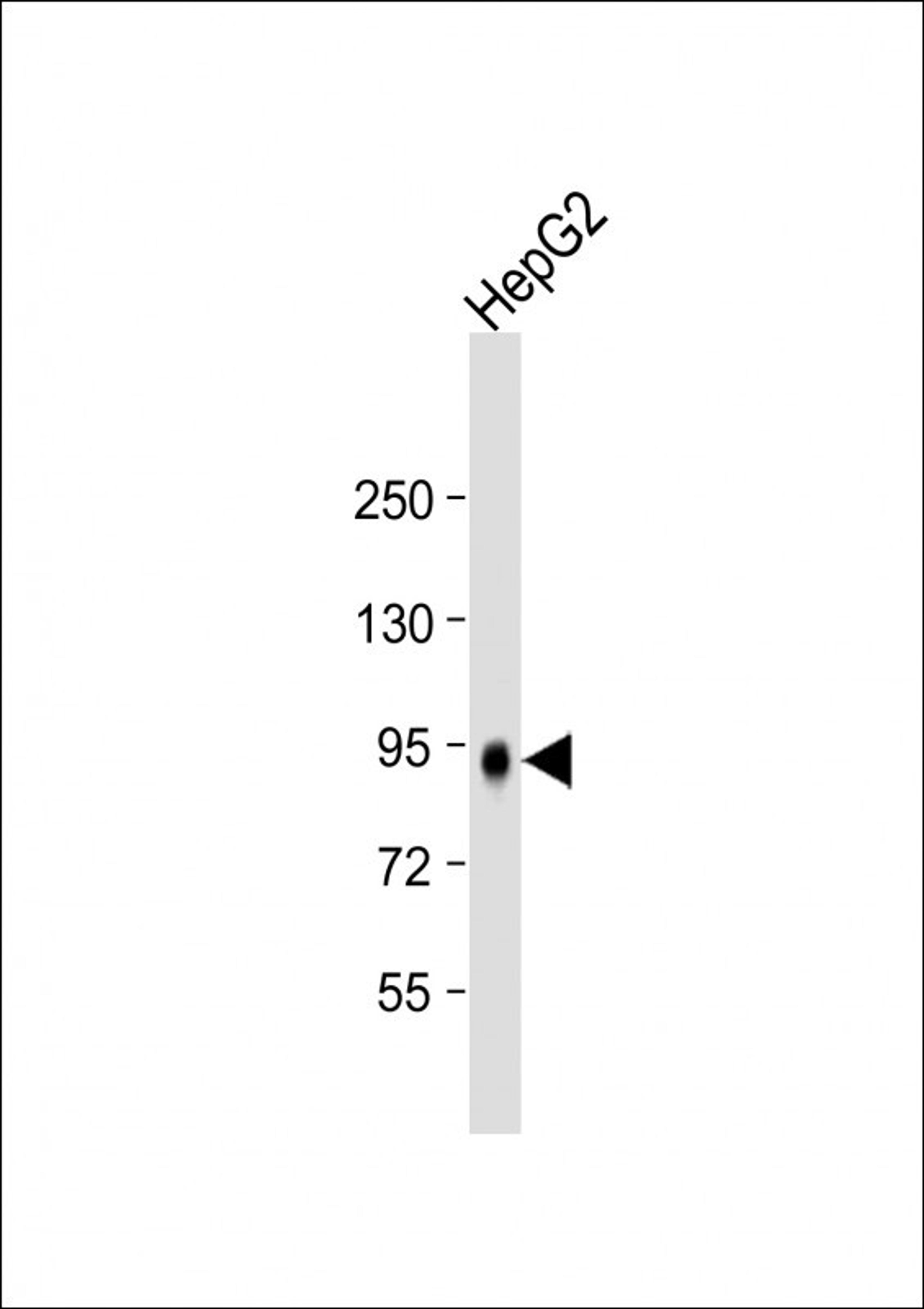 Western Blot at 1:2000 dilution + HepG2 whole cell lysate Lysates/proteins at 20 ug per lane.