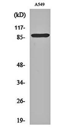 Western blot analysis of A549 cell lysates using Cleaved-Integrin alphaV HC (K889) antibody