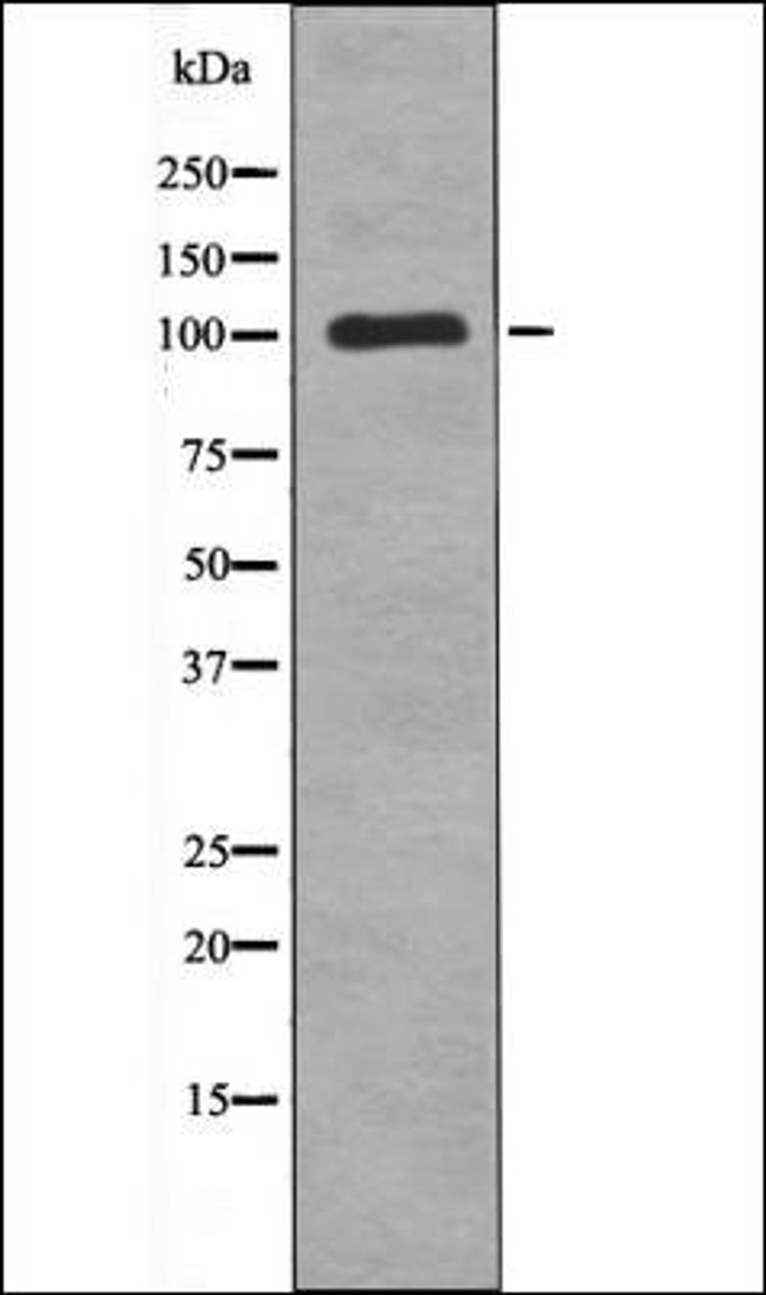 Western blot analysis of COLO205 whole cell lysates using TTK -Phospho-Thr676- antibody