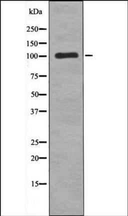 Western blot analysis of COLO205 whole cell lysates using TTK -Phospho-Thr676- antibody