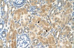 Antibody used in IHC on Human kidney.