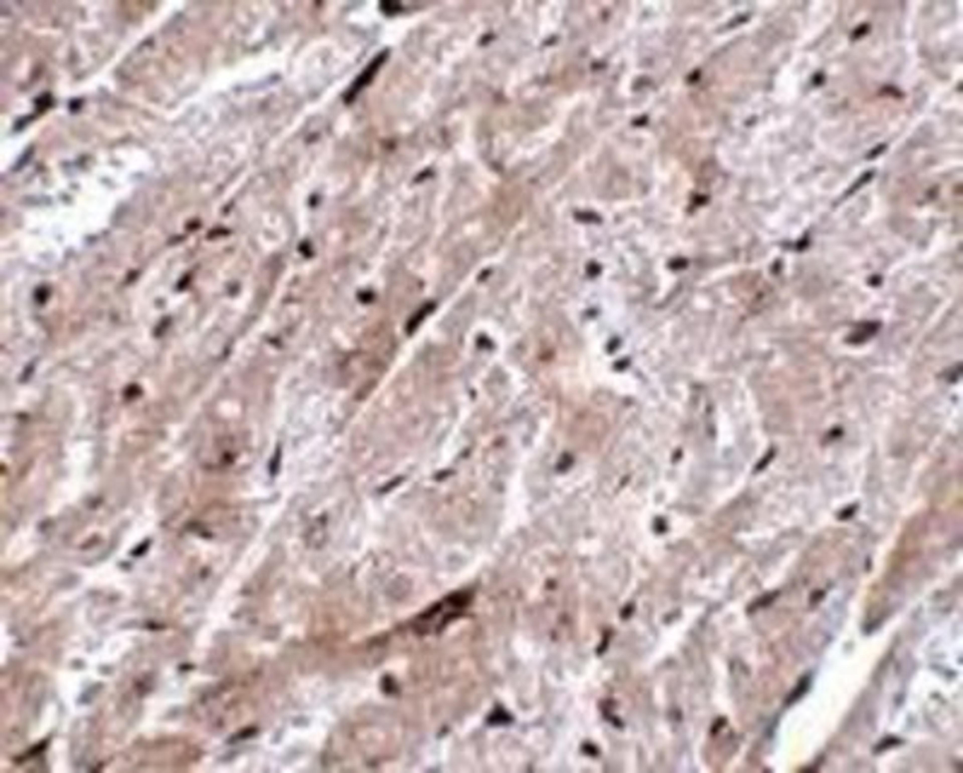 Immunohistochemistry-Paraffin: CEP164 Antibody [NBP1-77006] - Immunohistochemistry of CEP164 in mouse heart tissue with CEP164 antibody at 5 ug/ml.