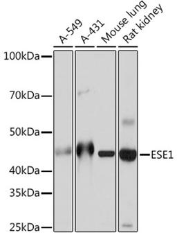 Western blot - ESE1 Rabbit mAb (A5236)