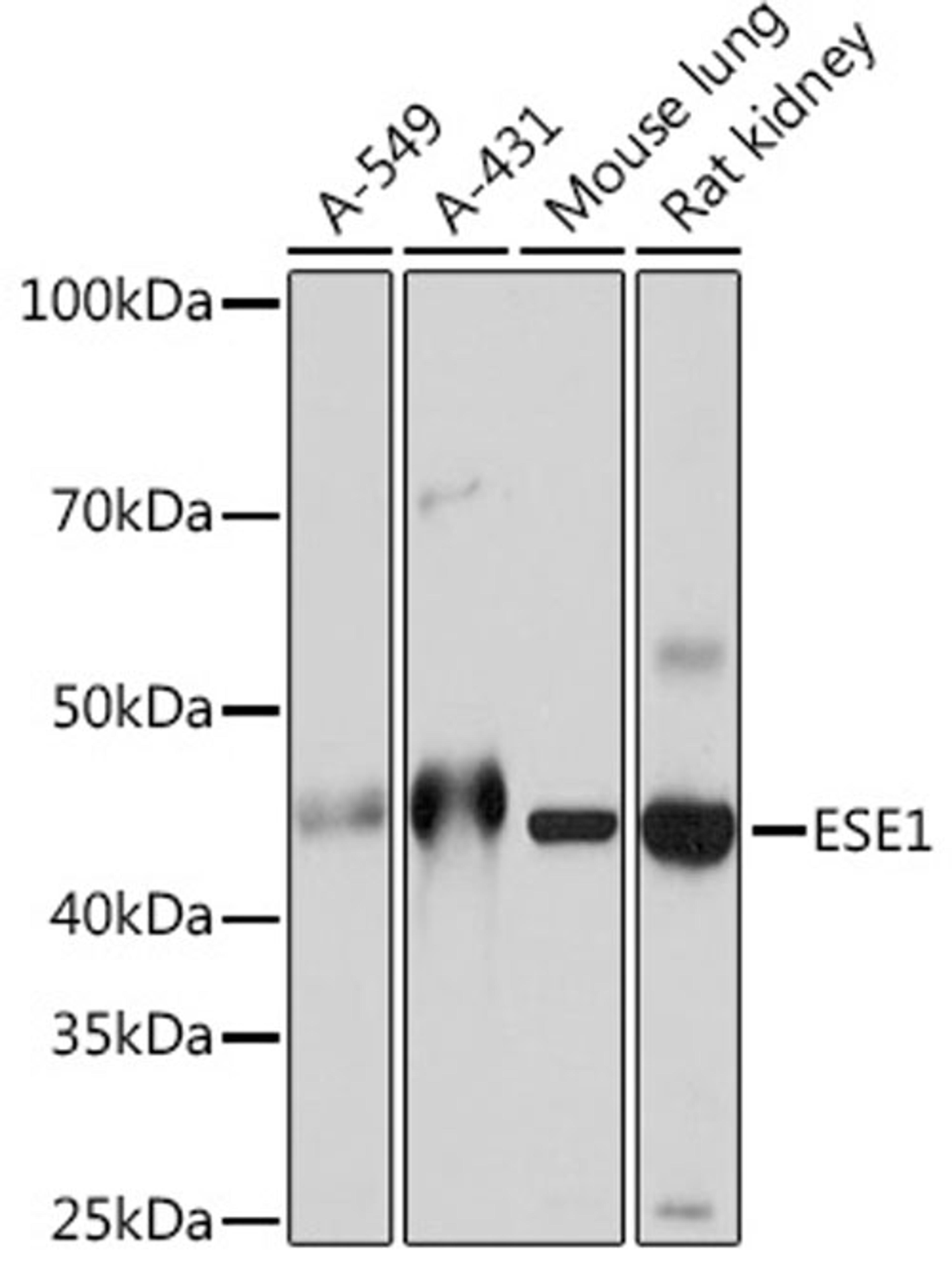 Western blot - ESE1 Rabbit mAb (A5236)