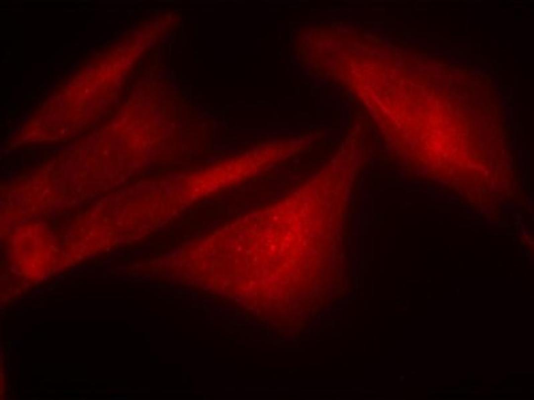 Immunocytochemistry/Immunofluorescence: G3BP1 [p Ser232] Antibody [NB100-81931] - Staining of methanol-fixed Hela cells.