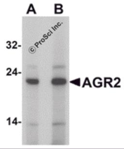 Western blot analysis of AGR2 in Hela cell lysate with AGR2 antibody at (A) 1 and (B) 2 &#956;g/mL