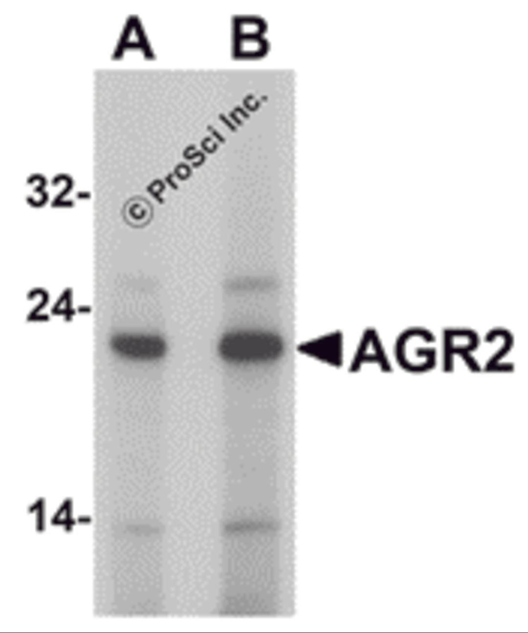 Western blot analysis of AGR2 in Hela cell lysate with AGR2 antibody at (A) 1 and (B) 2 μg/mL