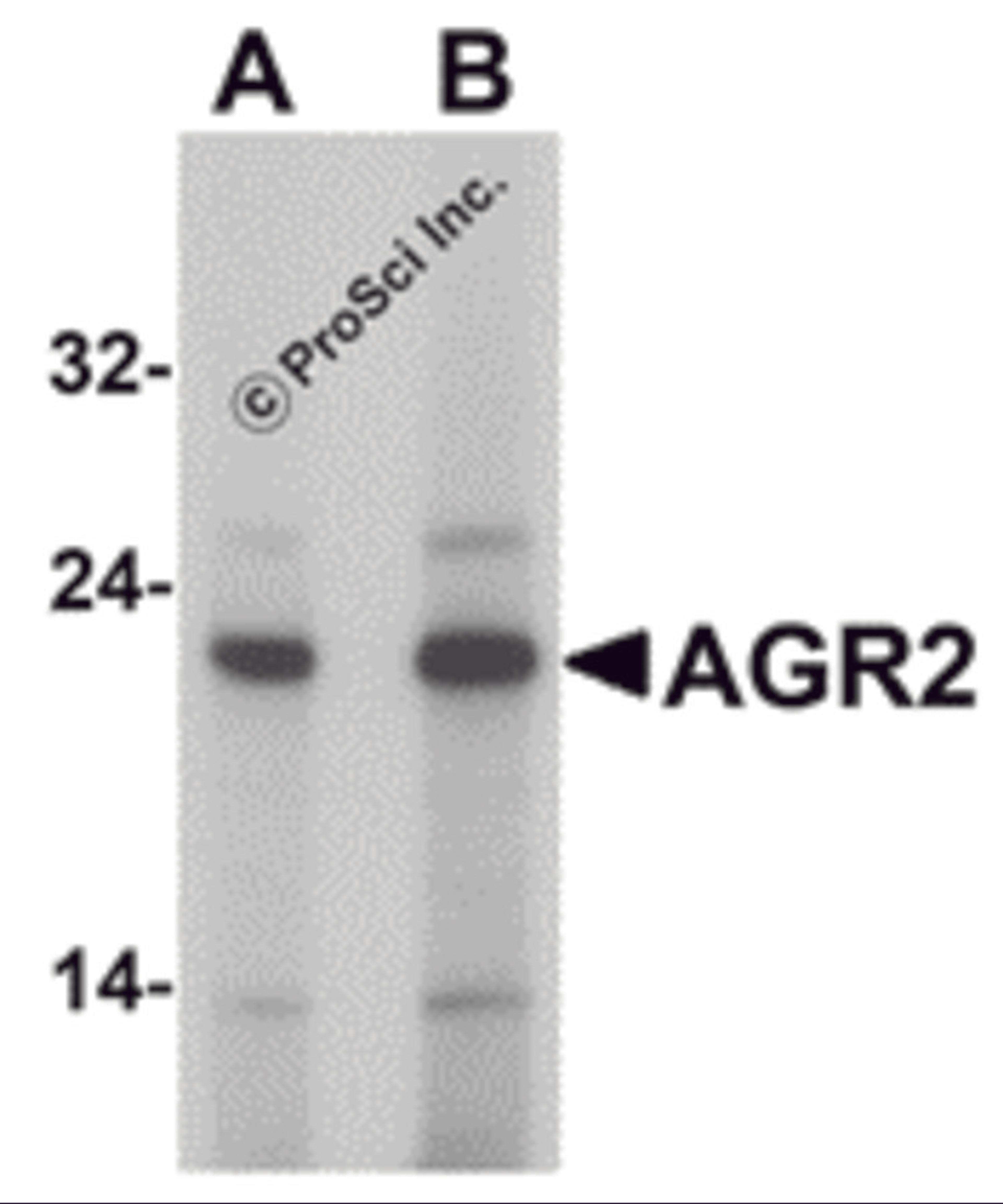 Western blot analysis of AGR2 in Hela cell lysate with AGR2 antibody at (A) 1 and (B) 2 μg/mL