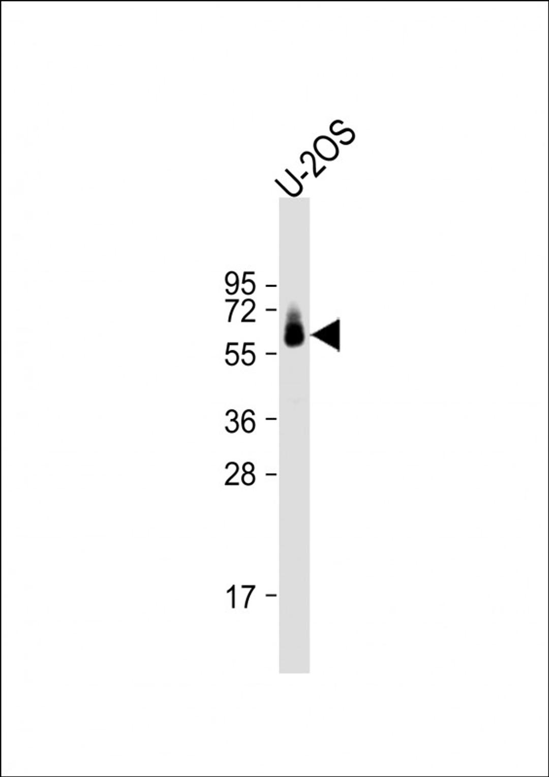 Western Blot at 1:1000 dilution + U-2OS whole cell lysate Lysates/proteins at 20 ug per lane.