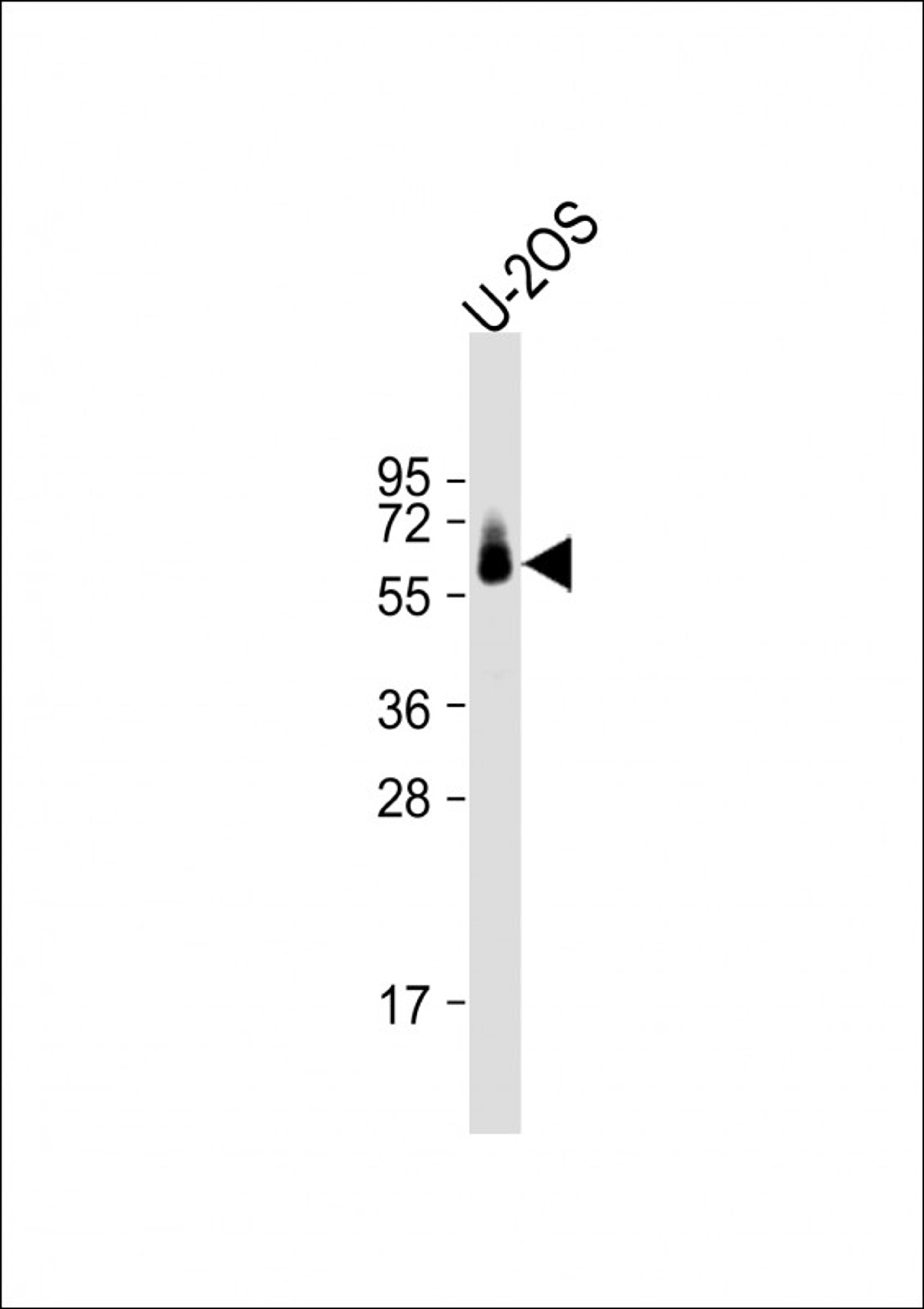 Western Blot at 1:1000 dilution + U-2OS whole cell lysate Lysates/proteins at 20 ug per lane.