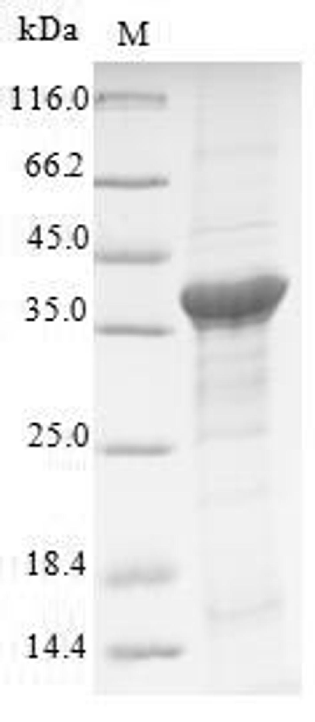 (Tris-Glycine gel) Discontinuous SDS-PAGE (reduced) with 5% enrichment gel and 15% separation gel.