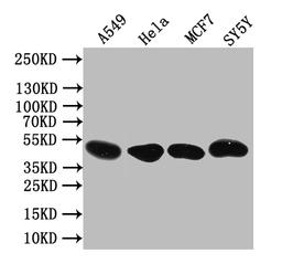 Western blot. All lanes: PLEKHS1 antibody at 1.5µg/ml + MDA-MB-231 whole cell lysate. Secondary. Goat polyclonal to rabbit IgG at 1/10000 dilution. Predicted band size: 52, 51, 41, 53 kDa. Observed band size: 52 kDa