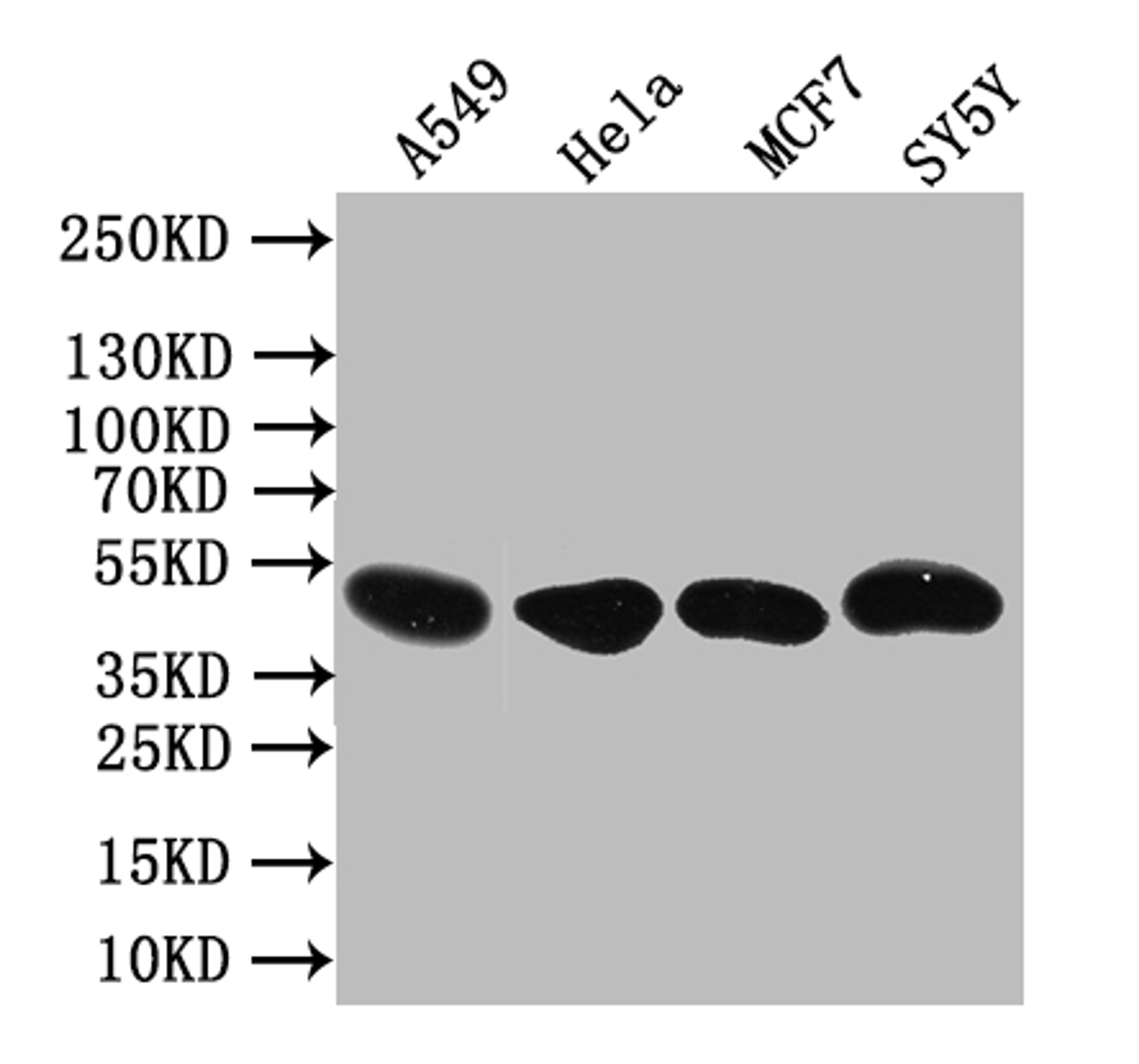 Western blot. All lanes: PLEKHS1 antibody at 1.5µg/ml + MDA-MB-231 whole cell lysate. Secondary. Goat polyclonal to rabbit IgG at 1/10000 dilution. Predicted band size: 52, 51, 41, 53 kDa. Observed band size: 52 kDa
