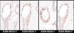 Detection of human HNF1-alpha by immunohistochemistry.